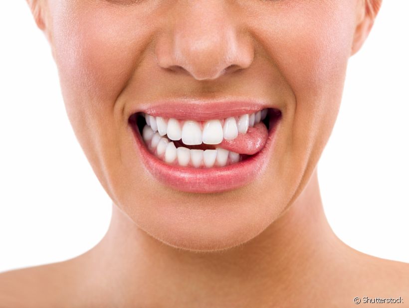 Você sabia que manchas nos dentes pode ser um sinal de alerta? O Sorrisologia vai te explicar melhor sobre esse assunto
