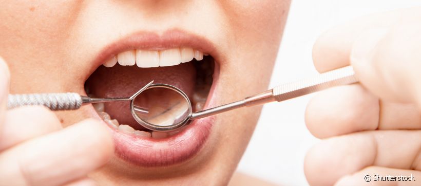 Ninguém quer passar pela extração de um dente, principalmente por conta da estética do sorriso. Mas, o procedimento pode ser necessário. Saiba se todos os dentes podem ser extraídos