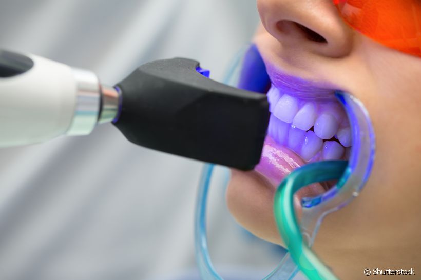 Por fazer uso de componentes químicos, será que o clareamento dental poderia prejudicar o esmalte dos dentes? O dentista Rodrigo Araújo explica