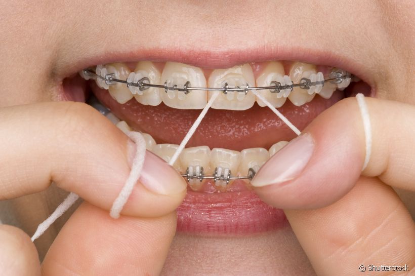 Para casos mais específicos, como o uso de aparelhos ortodônticos e próteses, existe o modelo dental floss que traz mais comodidade à sua limpeza interdental. Agora é só escolher o seu