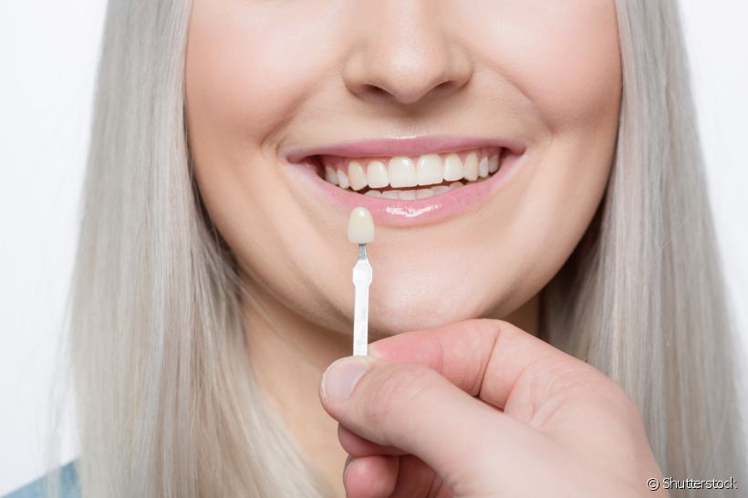 Você sabia que a lente de contato dental é uma solução para um sorriso perfeito? Entenda sobre o procedimento e quem pode fazê-lo