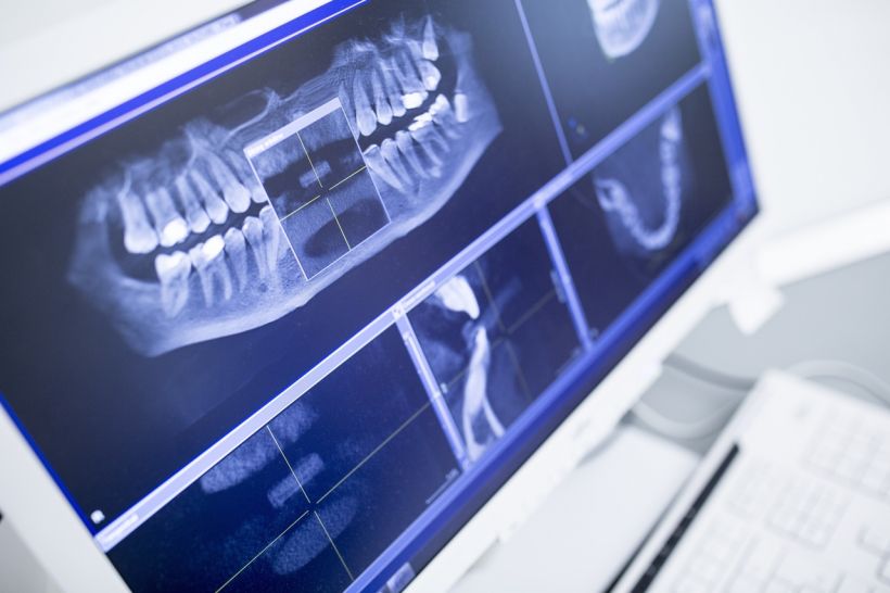 Scanners, simuladores 3D e projeções precisas da arcada dentária já são realidade: saiba mais sobre as técnicas de ortodontia digital